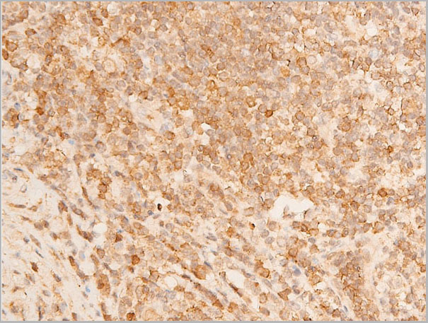 product-image-AAA30950_IHC5.jpg