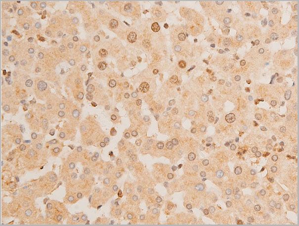 product-image-AAA30950_IHC6.jpg