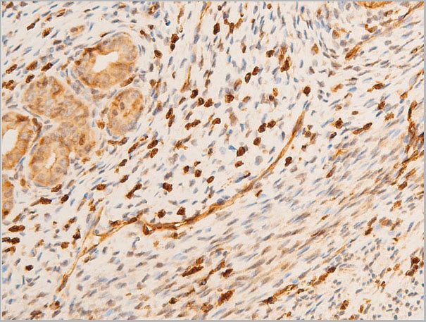 product-image-AAA30950_IHC7.jpg