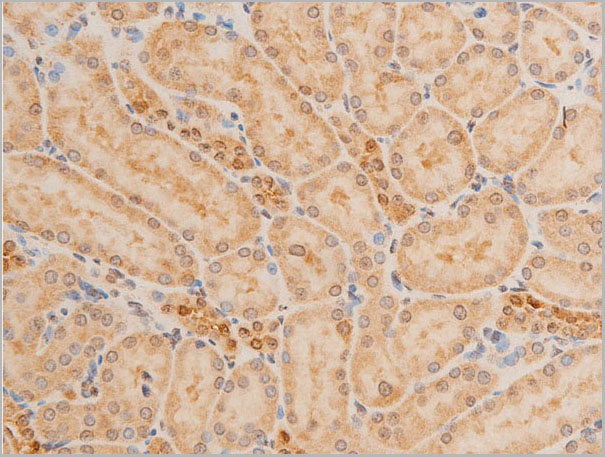 product-image-AAA30950_IHC8.jpg