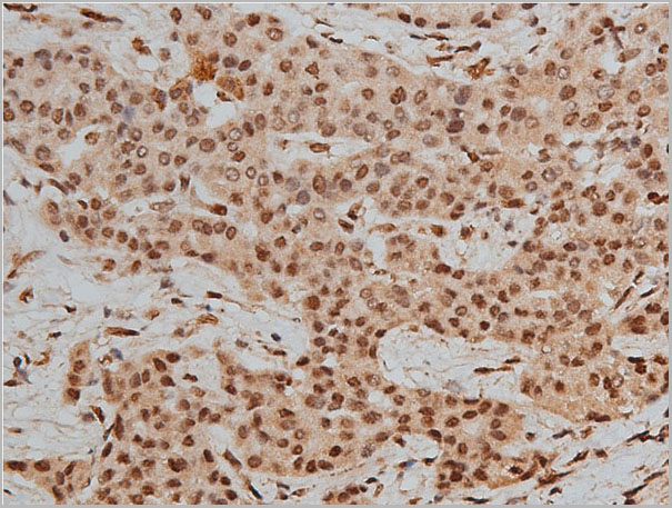 product-image-AAA30951_IHC5.jpg