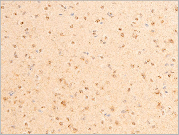 product-image-AAA30952_IHC2.jpg
