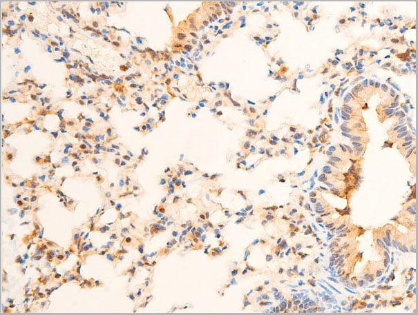 product-image-AAA30952_IHC3.jpg