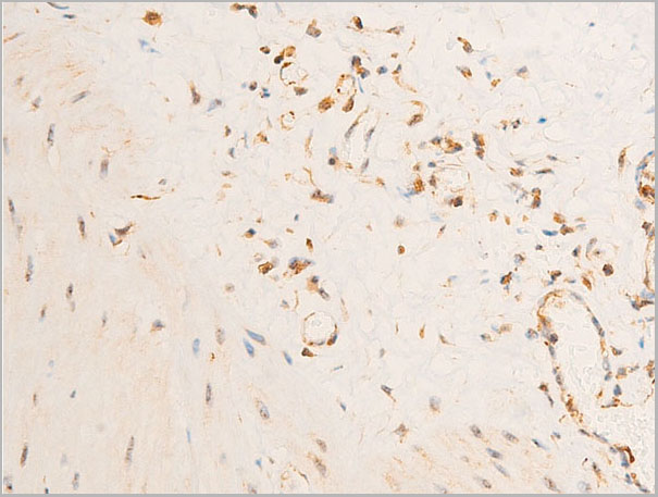 product-image-AAA30952_IHC4.jpg