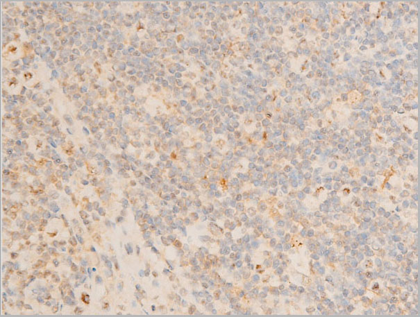product-image-AAA30952_IHC5.jpg