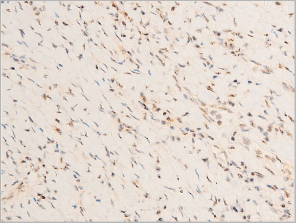 product-image-AAA30952_IHC6.jpg
