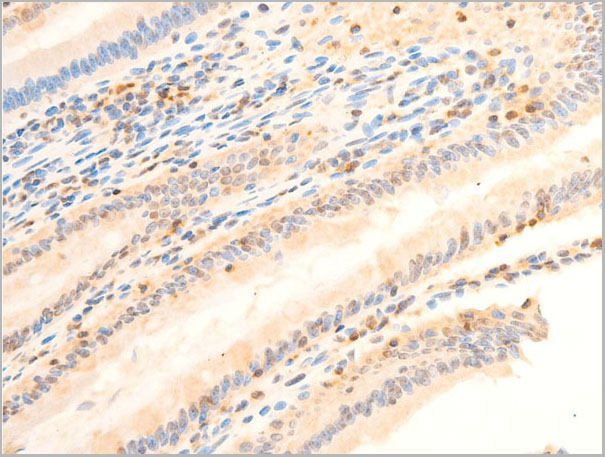 product-image-AAA30952_IHC9.jpg