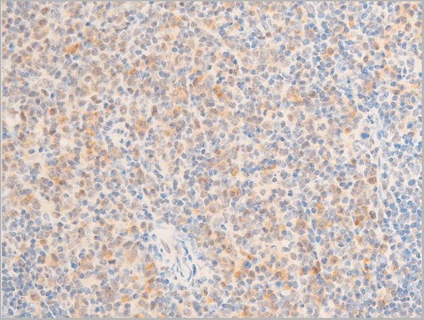 product-image-AAA30953_IHC4.jpg