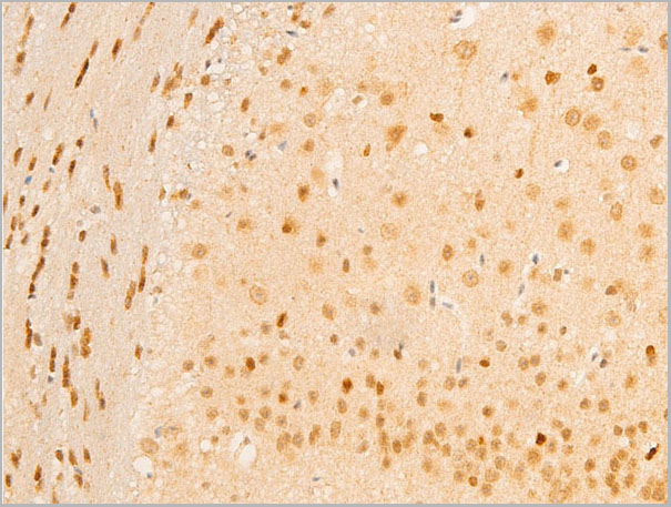product-image-AAA30953_IHC5.jpg