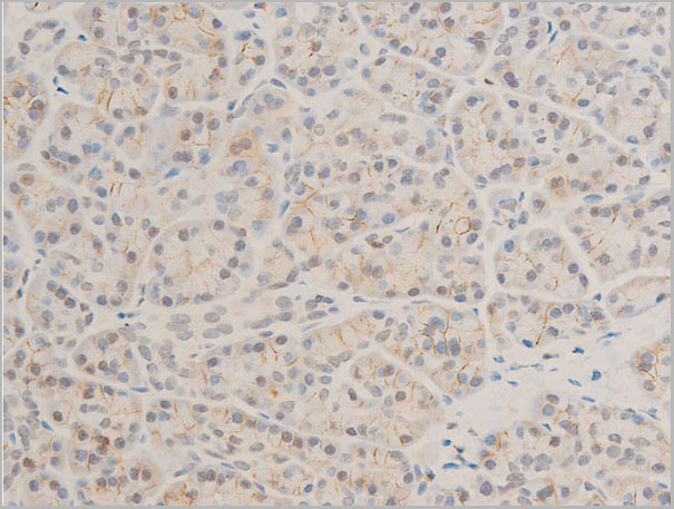 product-image-AAA30953_IHC7.jpg