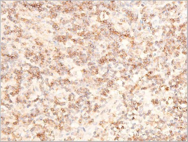 product-image-AAA30953_IHC8.jpg