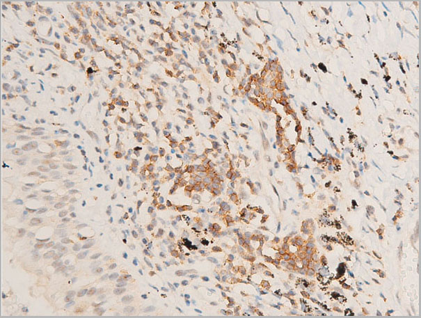 product-image-AAA30953_IHC9.jpg
