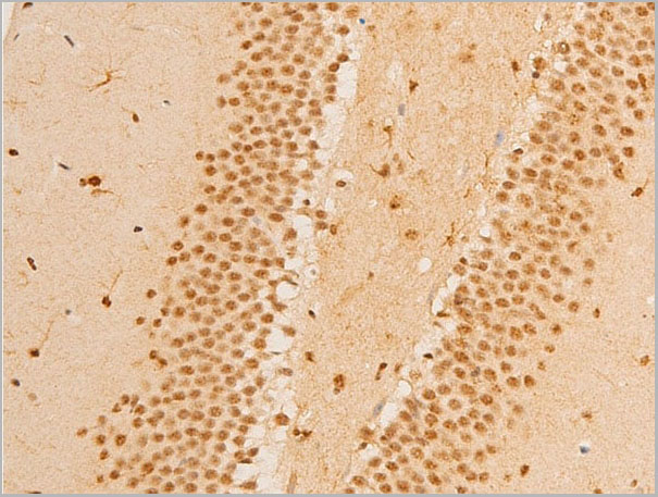 product-image-AAA30954_IHC3.jpg