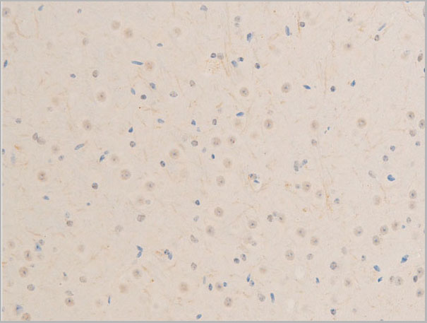 product-image-AAA30956_IHC5.jpg