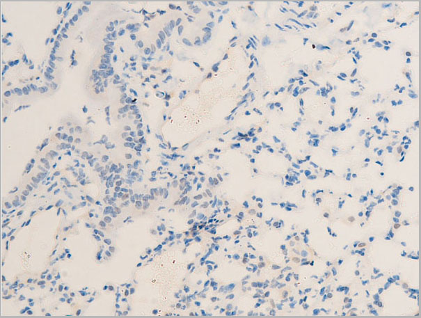 product-image-AAA30956_IHC6.jpg