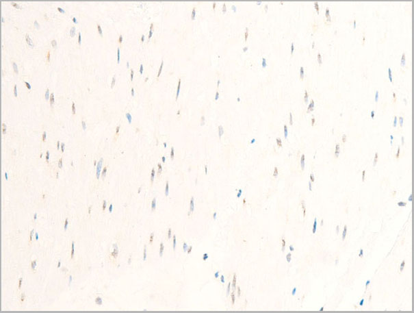 product-image-AAA30956_IHC7.jpg