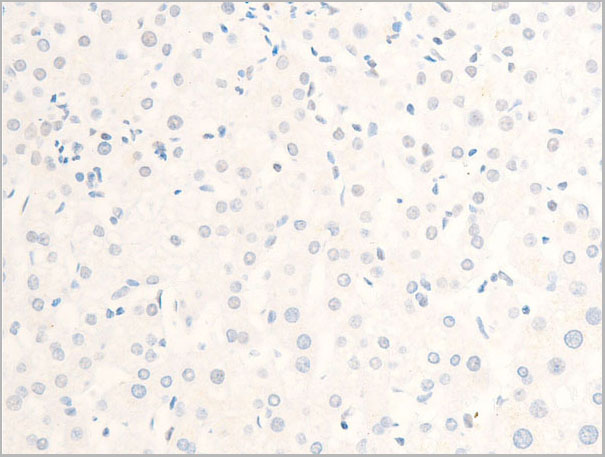 product-image-AAA30956_IHC8.jpg