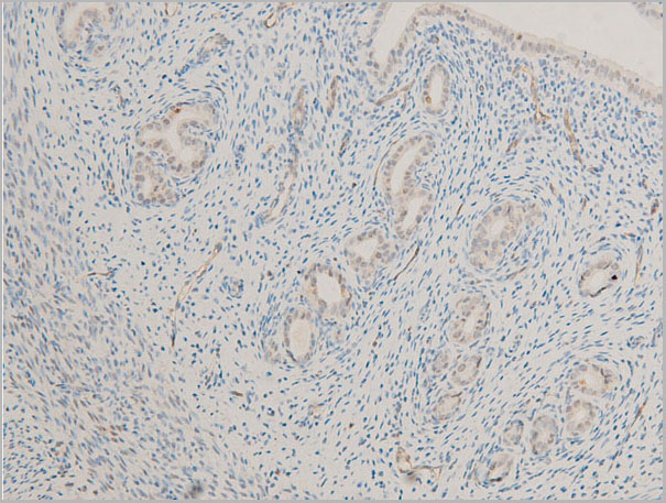 product-image-AAA30956_IHC9.jpg