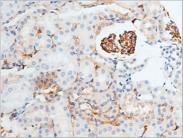 product-image-AAA30957_IHC2.jpg