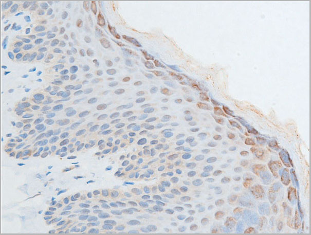 product-image-AAA30957_IHC3.jpg