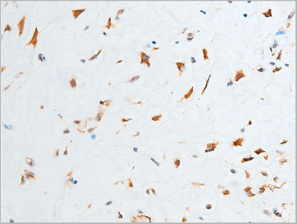 product-image-AAA30957_IHC4.jpg