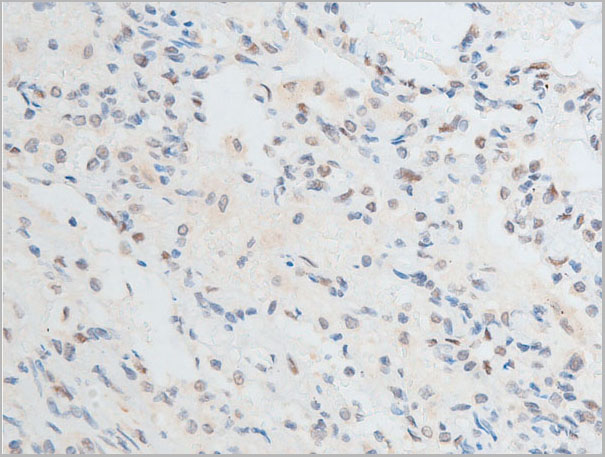product-image-AAA30957_IHC5.jpg