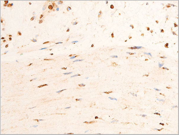 product-image-AAA30958_IHC4.jpg