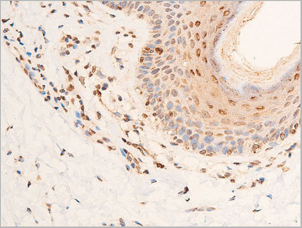 product-image-AAA30958_IHC5.jpg