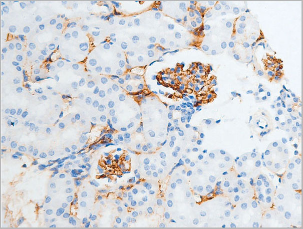 product-image-AAA30959_IHC4.jpg