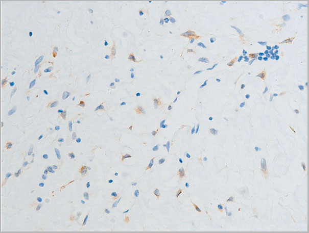product-image-AAA30959_IHC6.jpg