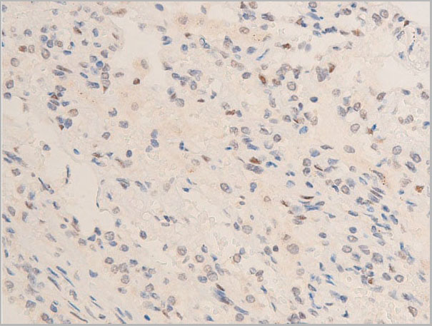 product-image-AAA30960_IHC10.jpg