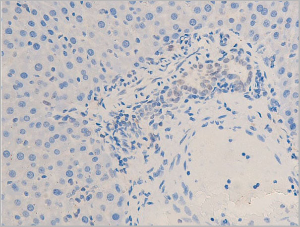 product-image-AAA30960_IHC12.jpg