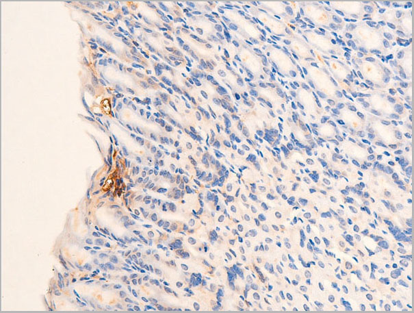 product-image-AAA30960_IHC5.jpg