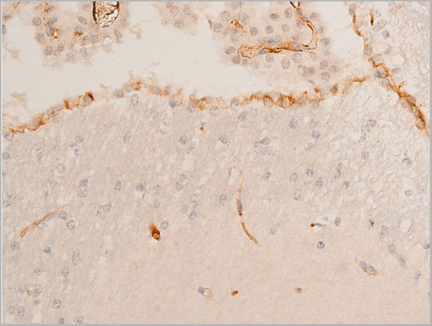 product-image-AAA30960_IHC6.jpg