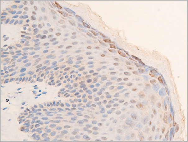 product-image-AAA30960_IHC8.jpg
