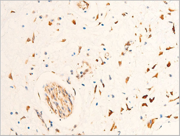 product-image-AAA30960_IHC9.jpg