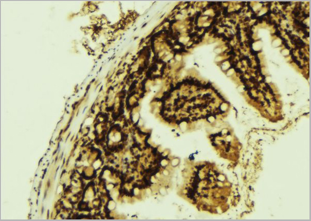 product-image-AAA30961_IHC4.jpg