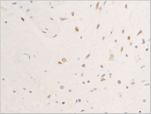 product-image-AAA30962_IHC2.jpg