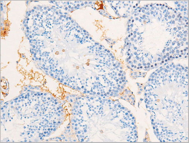product-image-AAA30962_IHC4.jpg