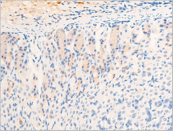 product-image-AAA30963_IHC2.jpg