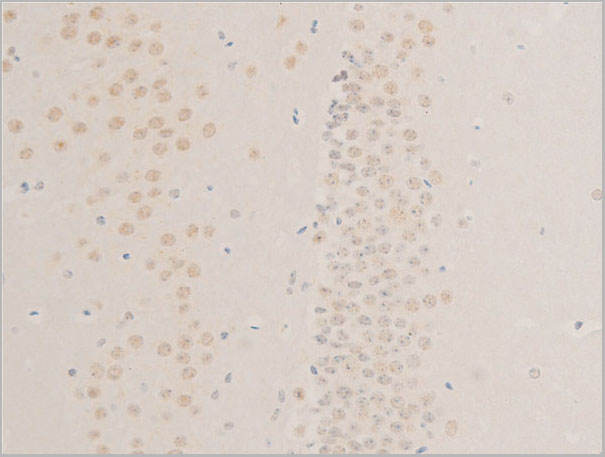 product-image-AAA30963_IHC3.jpg