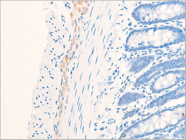 product-image-AAA30963_IHC4.jpg