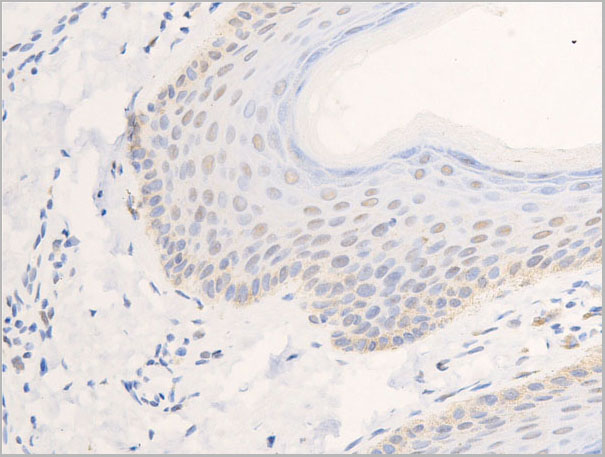 product-image-AAA30963_IHC5.jpg