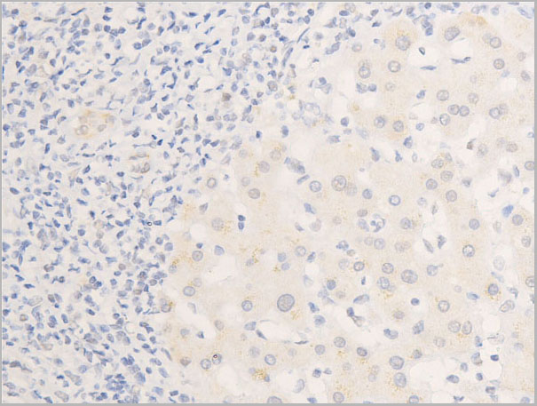 product-image-AAA30963_IHC6.jpg