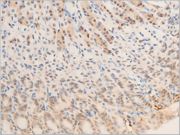 product-image-AAA30964_IHC2.jpg