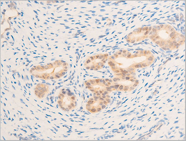 product-image-AAA30964_IHC3.jpg