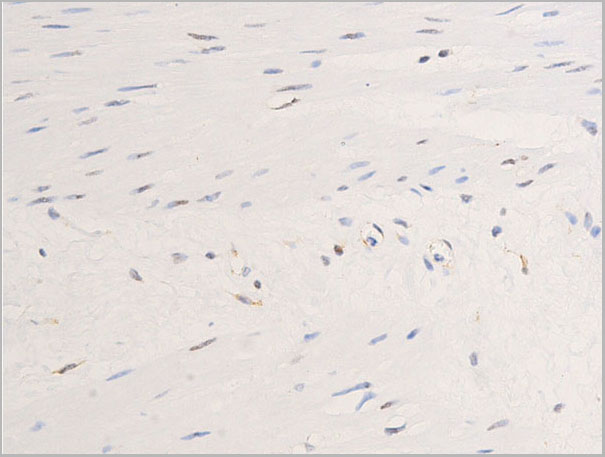 product-image-AAA30964_IHC4.jpg