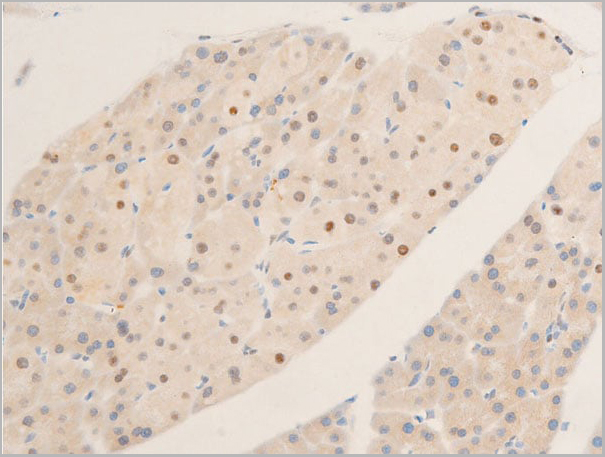 product-image-AAA30965_IHC11.jpg