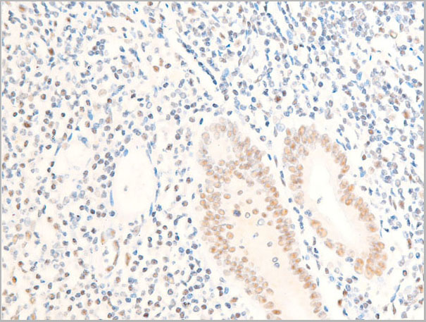 product-image-AAA30965_IHC2.jpg