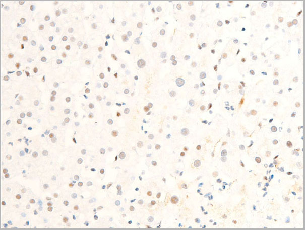 product-image-AAA30965_IHC3.jpg